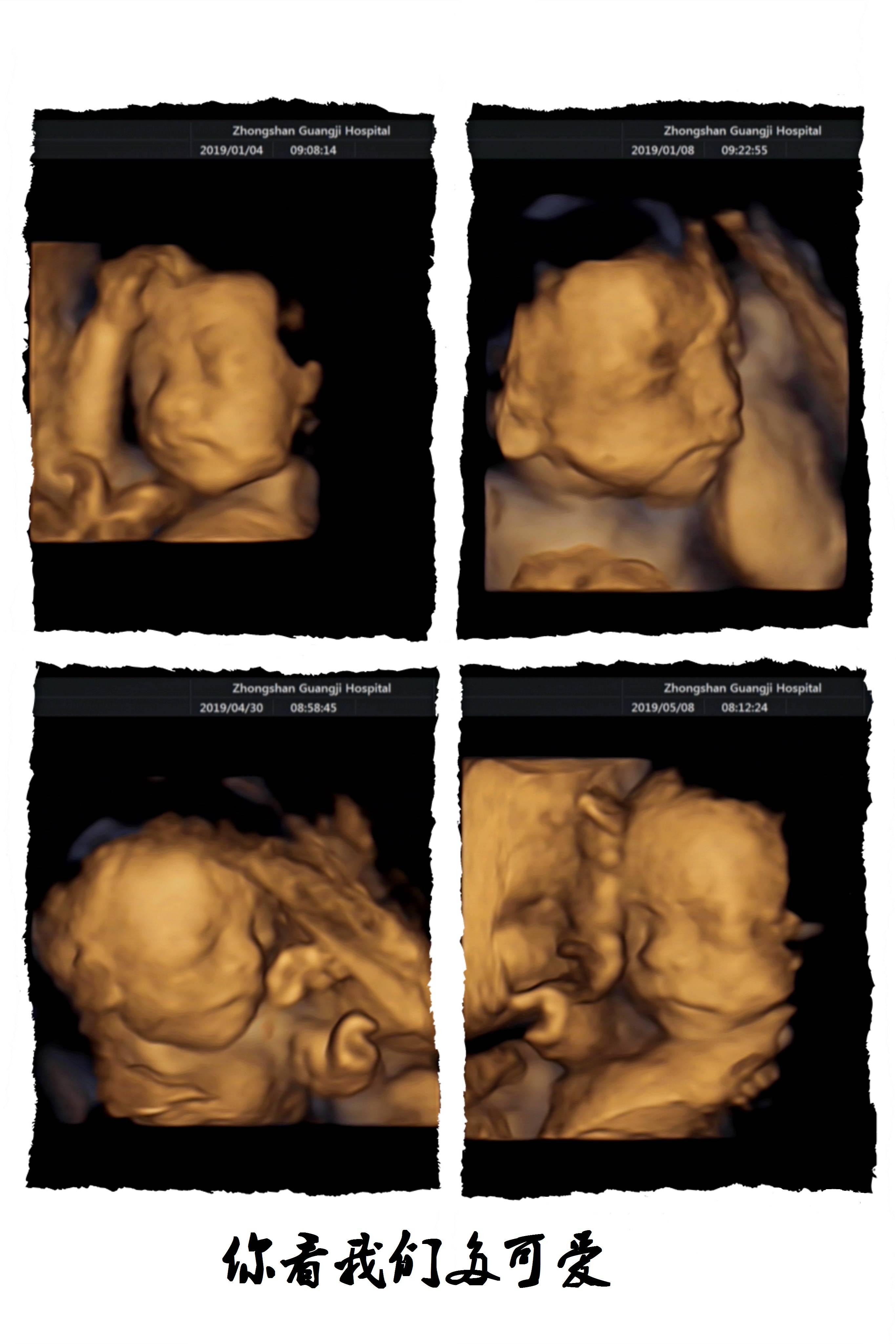 二十四周胎儿发育图片图片