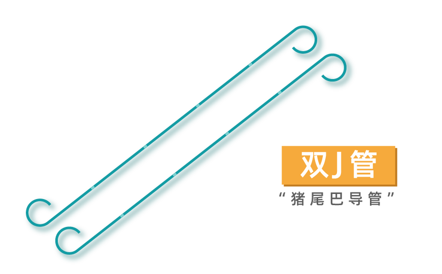 杭州城东医院泌尿外科李智:"猪尾巴导管"丨材质虽软,养护却不能少