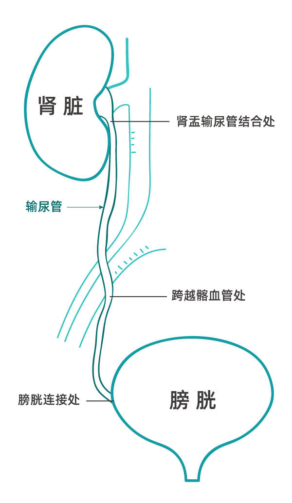 输尿管和膀胱示意图图片