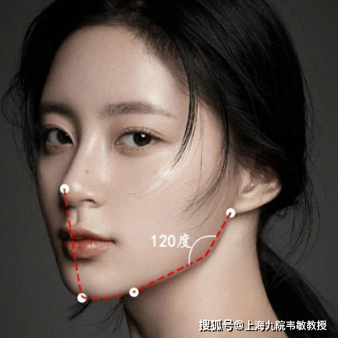 原创上海九院韦敏丨聊一聊下颌角截骨都有哪些可能实施方案呢
