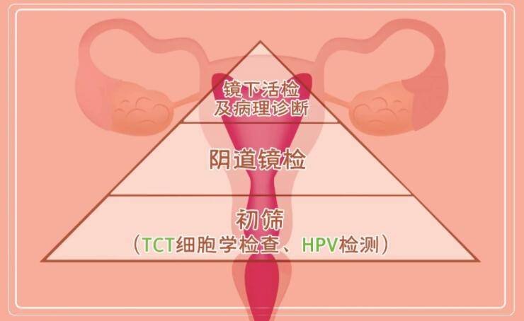 成都哪家医院做宫颈筛查比较好?（第一试管网）