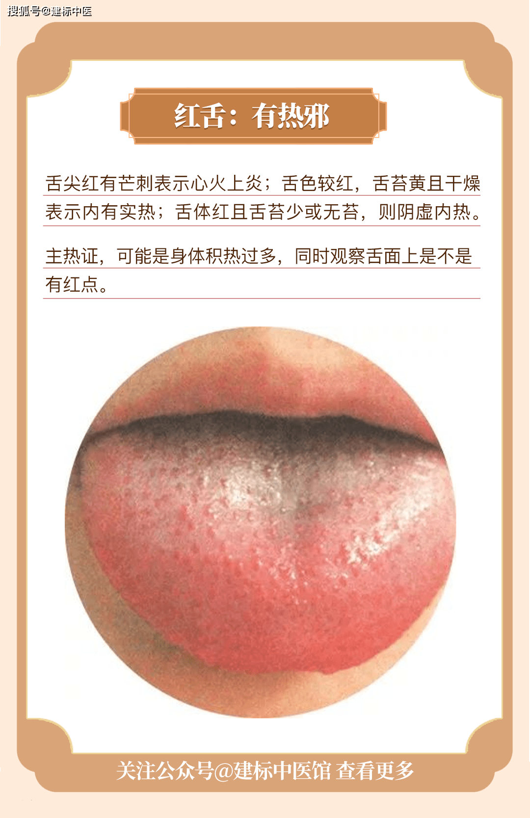 快跟着学习如何给自己"舌诊"_身体_图片_舌苔