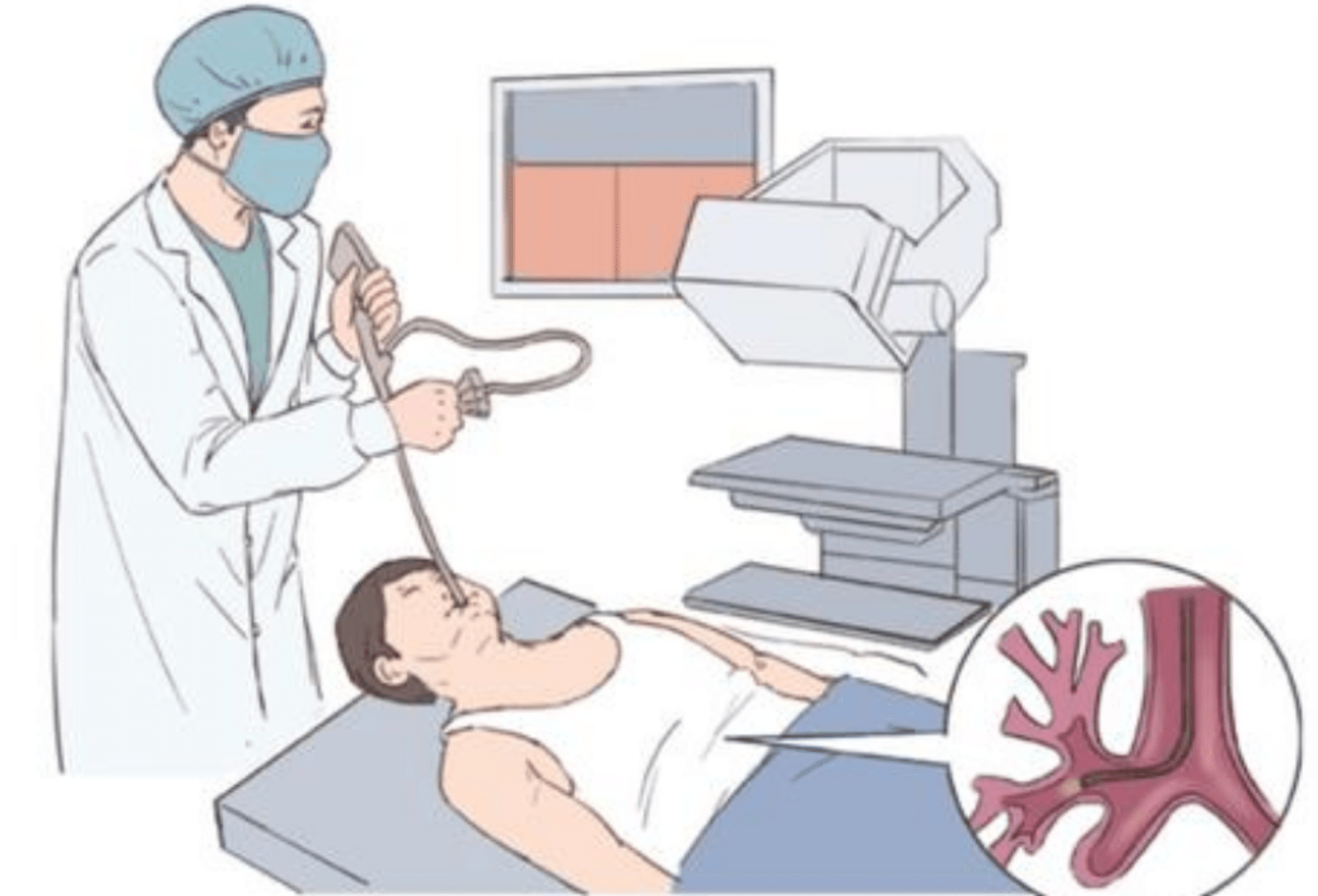 什么是无痛纤支镜?_检查_气管_患者