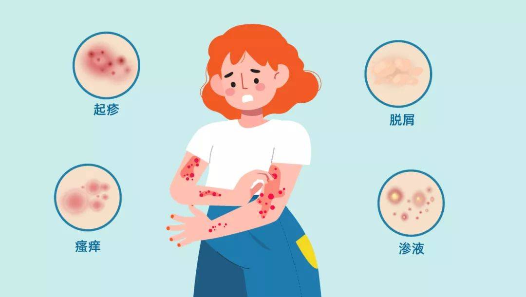 达必妥和脱敏治疗哪个好?有什么区别?_香港_医生_时候