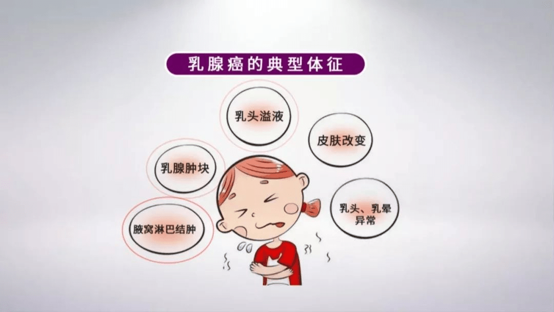 艾博尔科普 摸到乳房有肿块