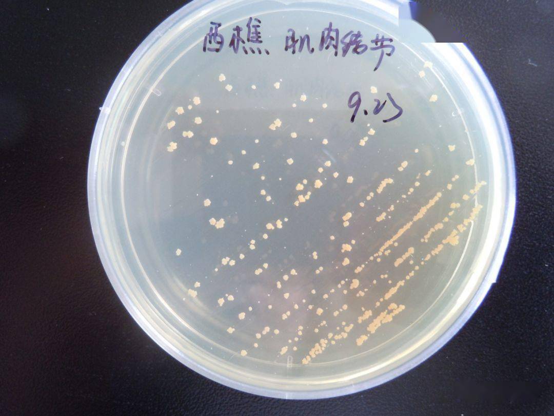 在普通培养基上面分离诺卡氏菌,常温条件下(25-28℃)需要10天以上