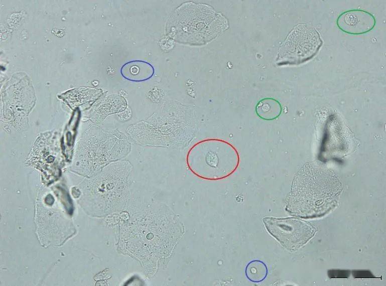 滴虫显微镜下图片40倍图片