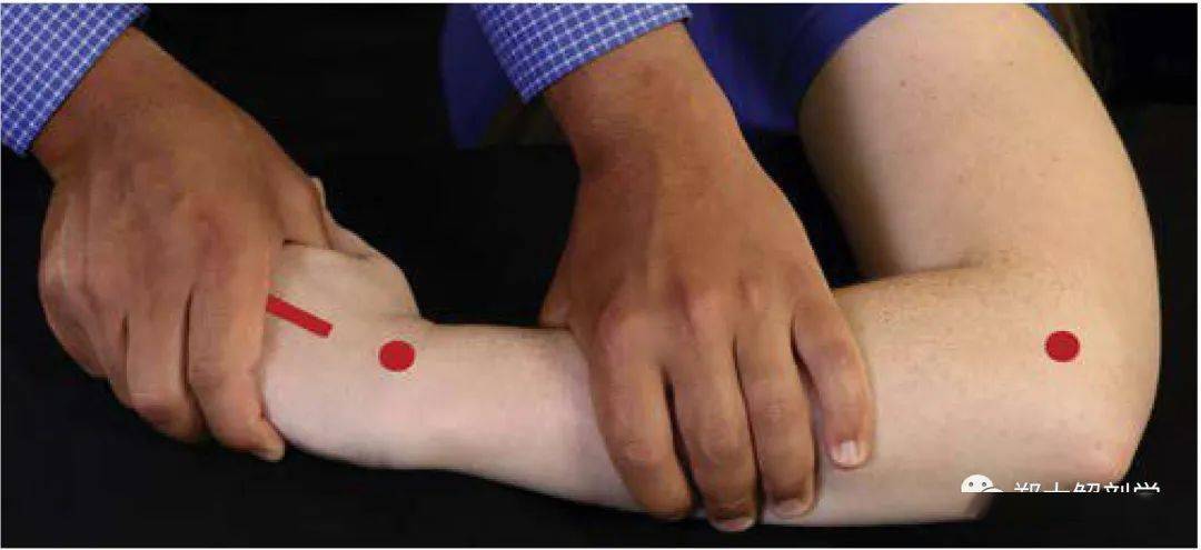 手腕外展rom结束,显示适当的手部放置,以稳定前臂和内收手腕.
