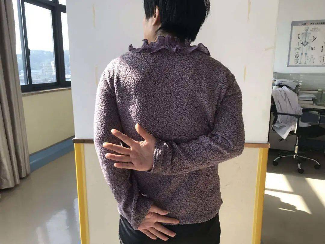 只需10分钟丨肩膀冻住了胳膊根本抬不起来桐庐县中医院开展冻结肩手法