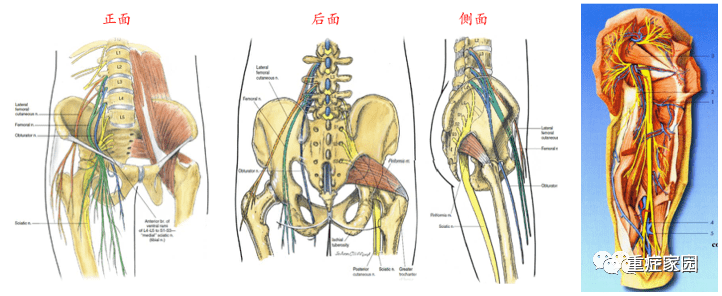 坐骨结节手术示意图图片