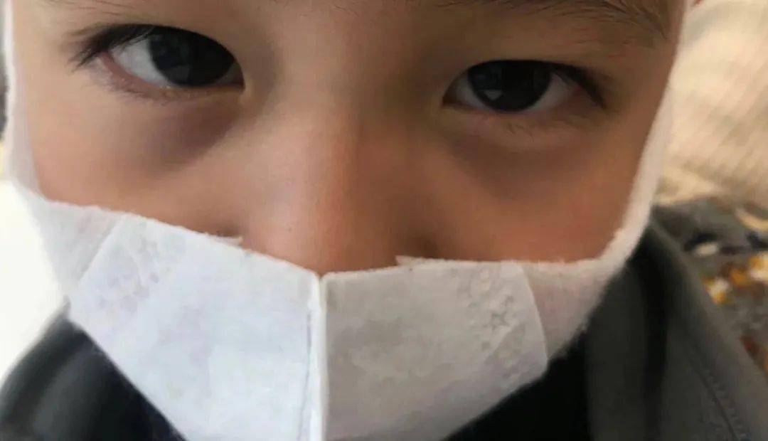 的,黑眼圈,注意力涣散,甚至厌食(这都是长期睡眠不佳 大脑缺氧造成)5