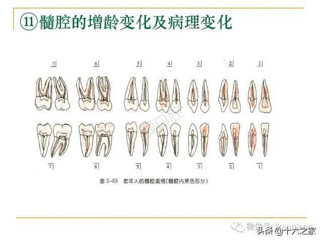 牙體髓腔解剖系統開髓開髓洞型及根管常用器械的認識和使用