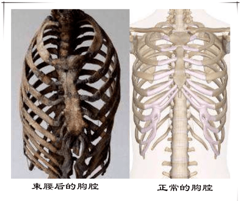 束腰后的胸腔和正常胸腔对比而但是女性的内脏位置,是这样的.