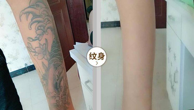 关于自动化机械手臂鸡皮肤纹身的信息