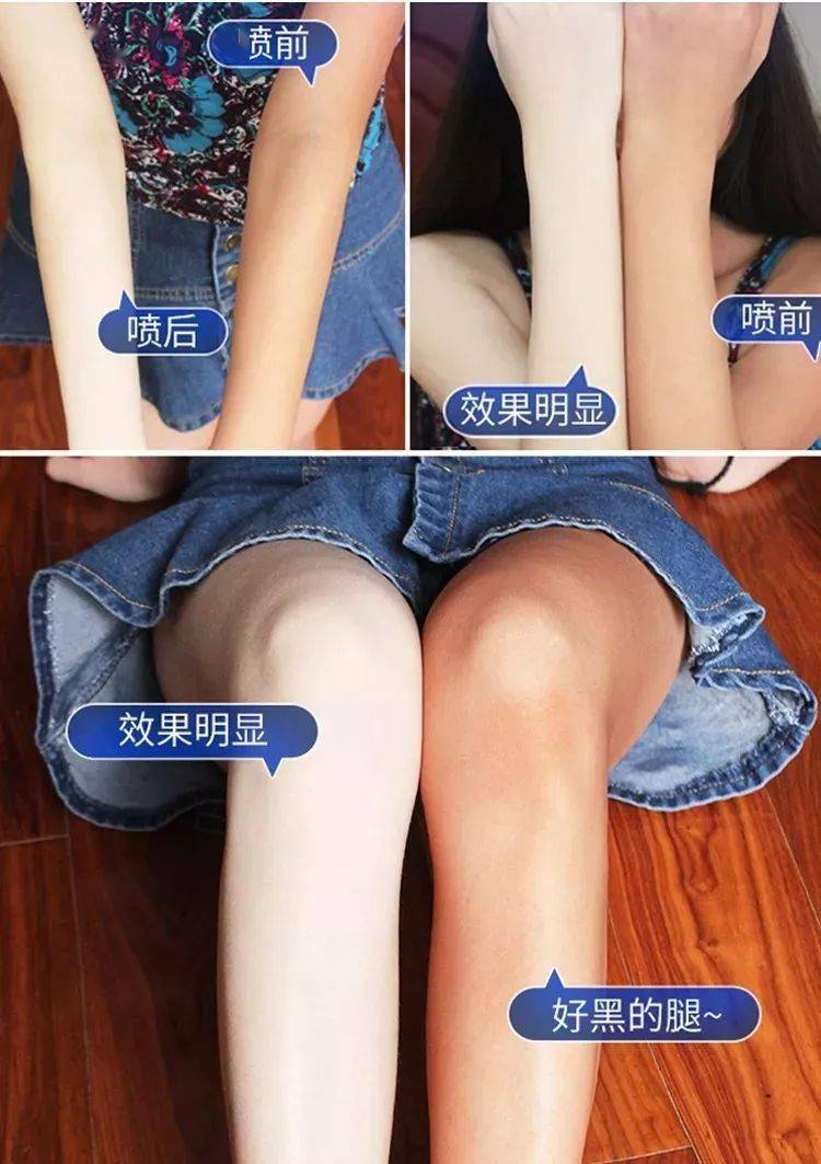 那个遮瑕可以遮住鸡皮肤(鸡皮肤遮瑕效果好的遮瑕霜)