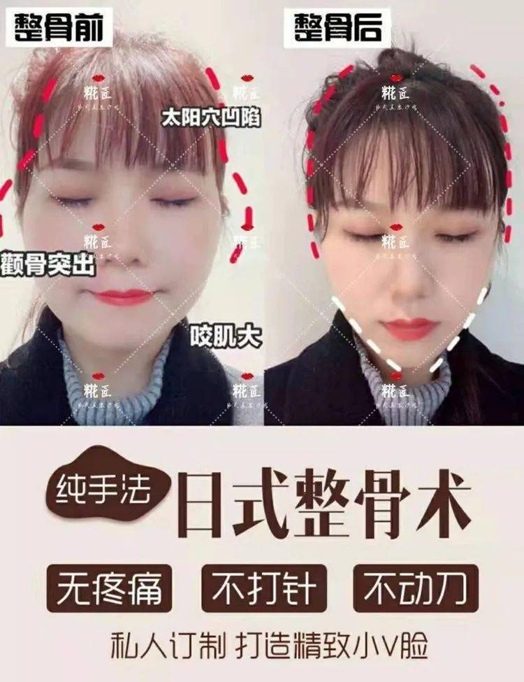 最后达到骨骼矫正塑形,让骨骼回归自然,平衡,健康的状态