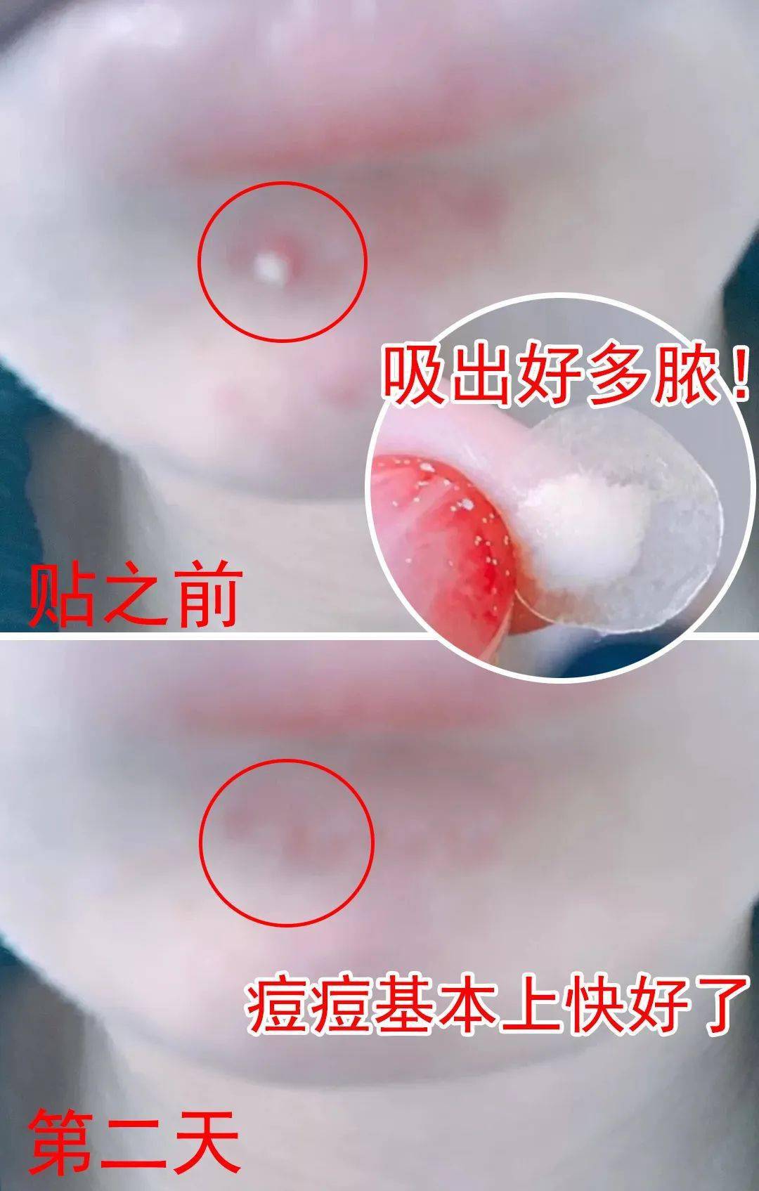 让肌肤变成"白煮蛋",就是这么简单!