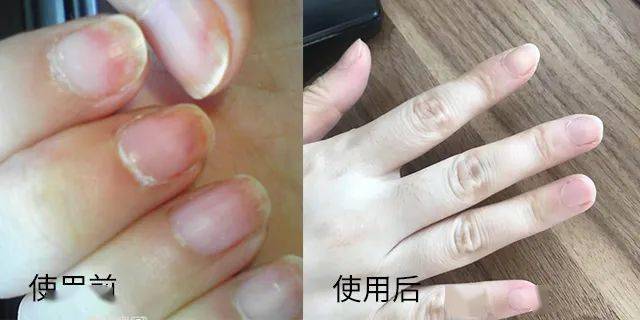 指甲的生长过程图片
