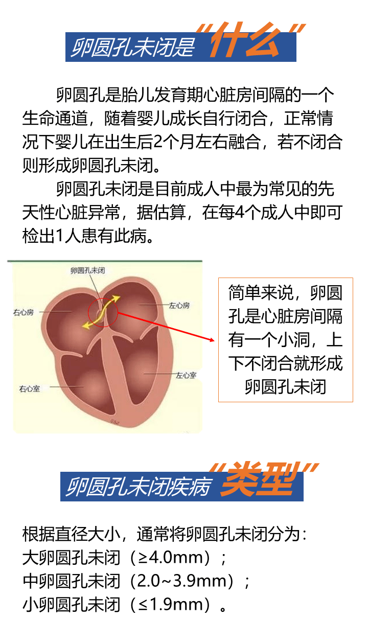 卵圆孔闭合时间图片