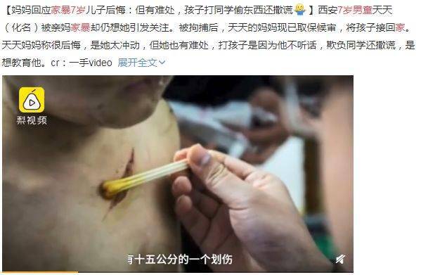 7岁男童被亲妈毒打2年胸口被刀划出15公分伤痕用力过猛的严厉教育正在