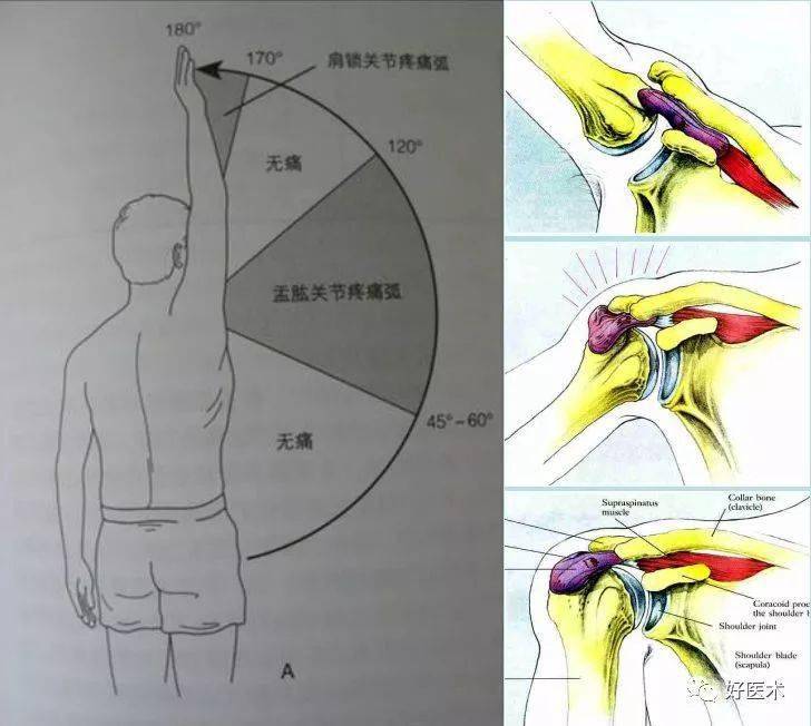 收藏最全肩关节解剖及查体方法汇总