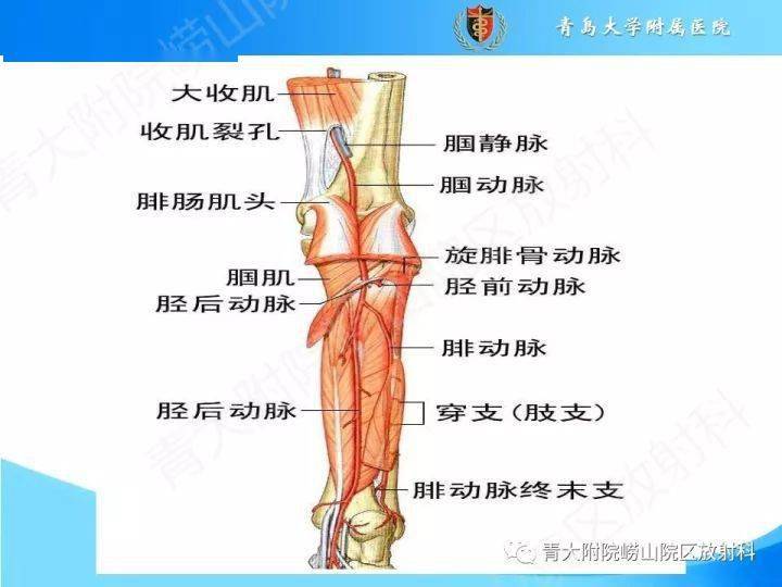 下肢动脉解剖图图片