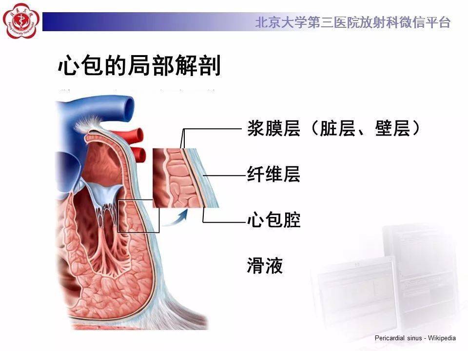 影像精美解剖丨心包窦及心包隐窝解剖建议收藏