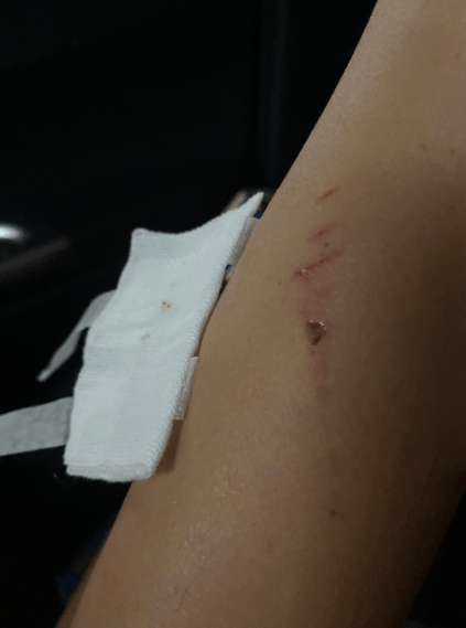 精装房浴室玻璃门炸裂,19岁女孩身上多处被扎伤_自爆