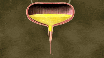 达到一定量了再"嘘嘘"……说白了,尿潴留就是膀胱容量"爆表"了!