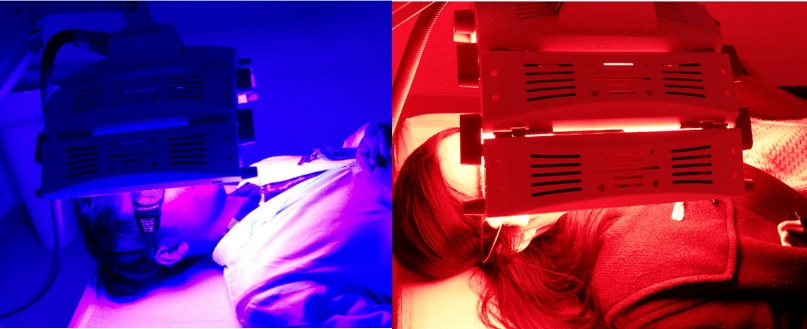 红蓝光光疗法治疗痤疮,毛囊炎