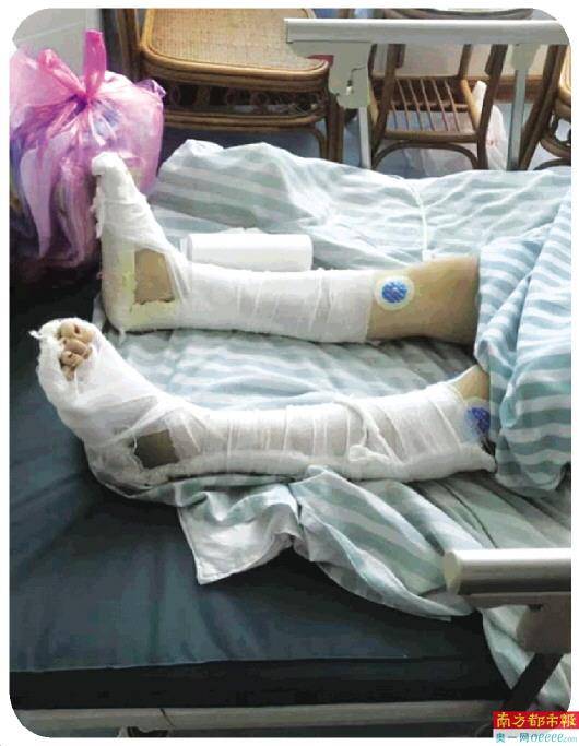 反抗家暴跳楼逃生 为离婚坐轮椅奔波两月