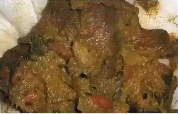 宝宝如果拉这4种便便,一定要尽快去医院!