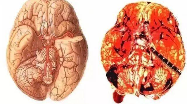 安顺警方历经半年斩断贩毒通道!