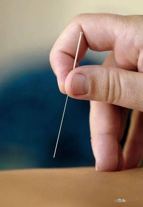 子午流注针法与时间性病症