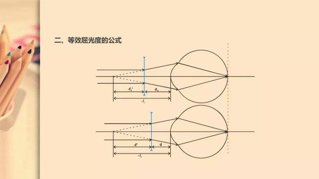 眼视光镜眼距与等效度