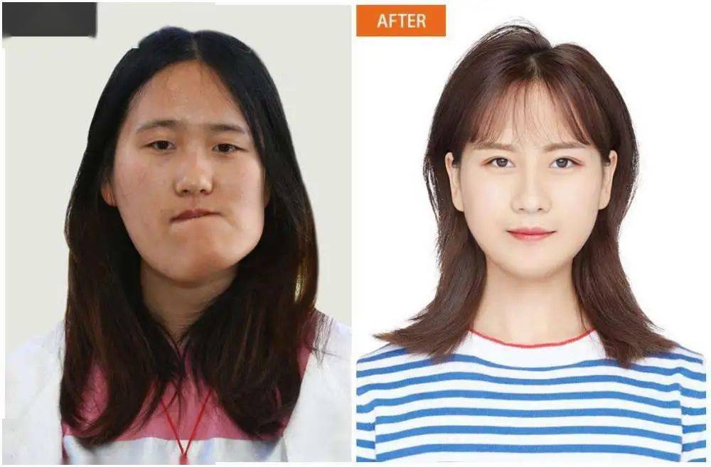 来源:央视新闻,浙江在线 她曾是一个面部畸形的"歪脸女孩 因长相而