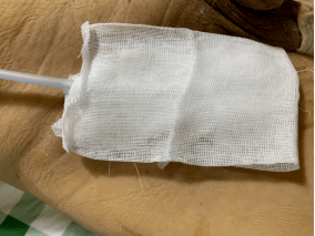 如何自己制作负压引流装置这里有一份图文教程送给你