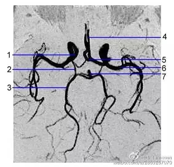 解剖顱內血管 | 超詳腦供血系統分類_動脈