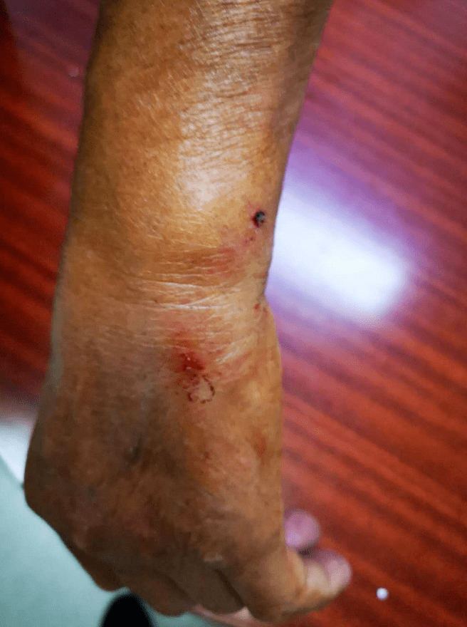 太惨了蛇咬狗狗咬人蛇狗都死了人该怎么办