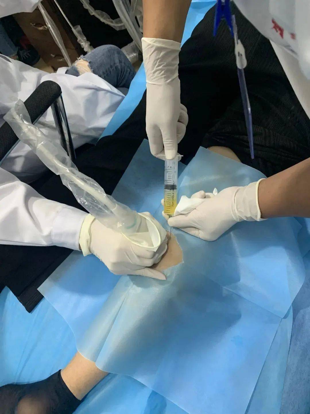 一根"细针" 打通为民服务的"最后一公里"