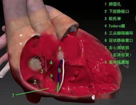 3d心臟解剖看看心臟到底長啥樣