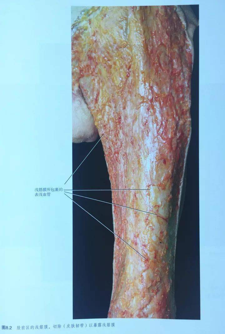 掌握"下肢浅筋膜",临床医生不可或缺_结构