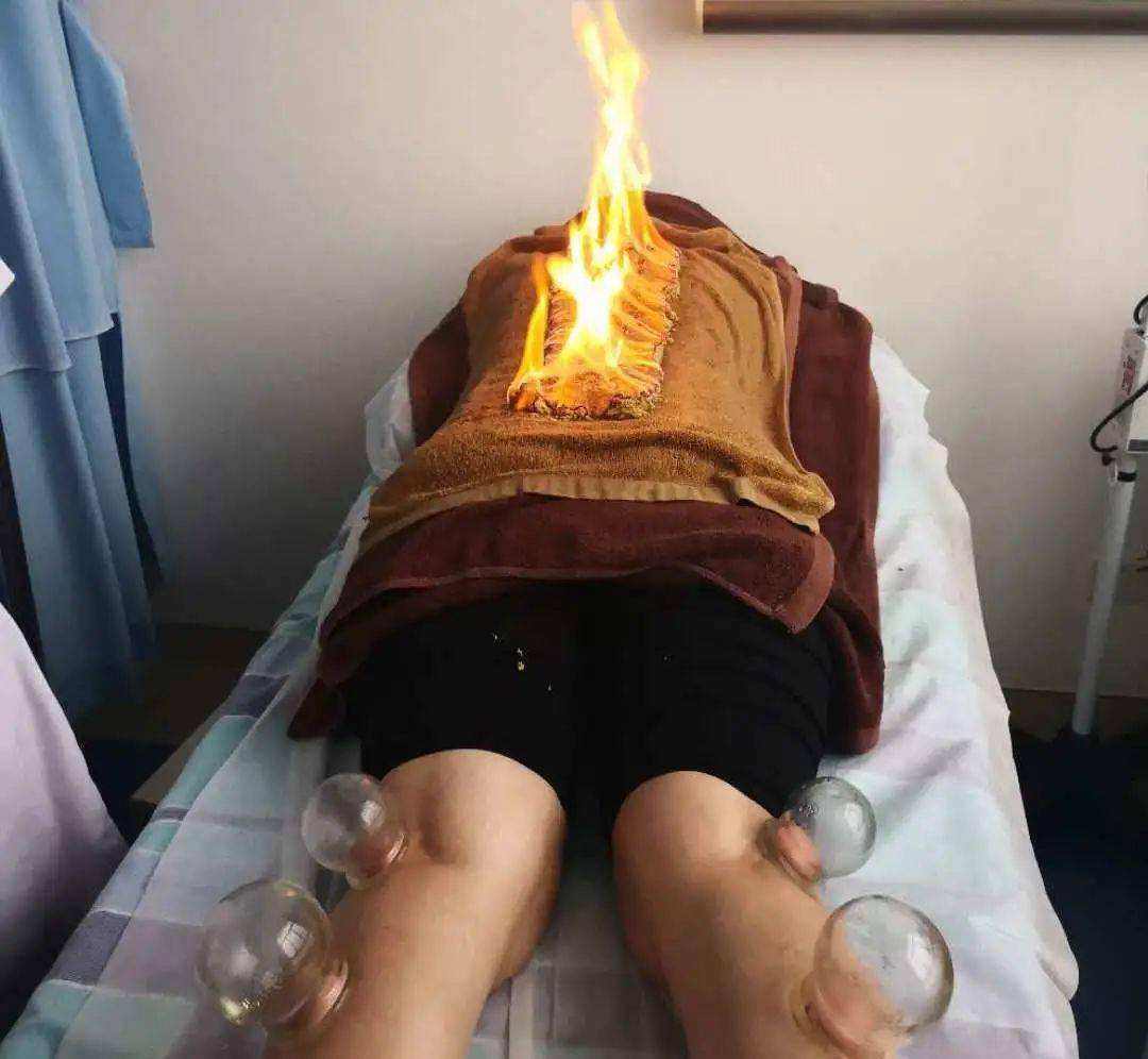 督脉灸通过经络,腧穴,药物,艾灸,发泡等多种因素共同作用,发挥经络的