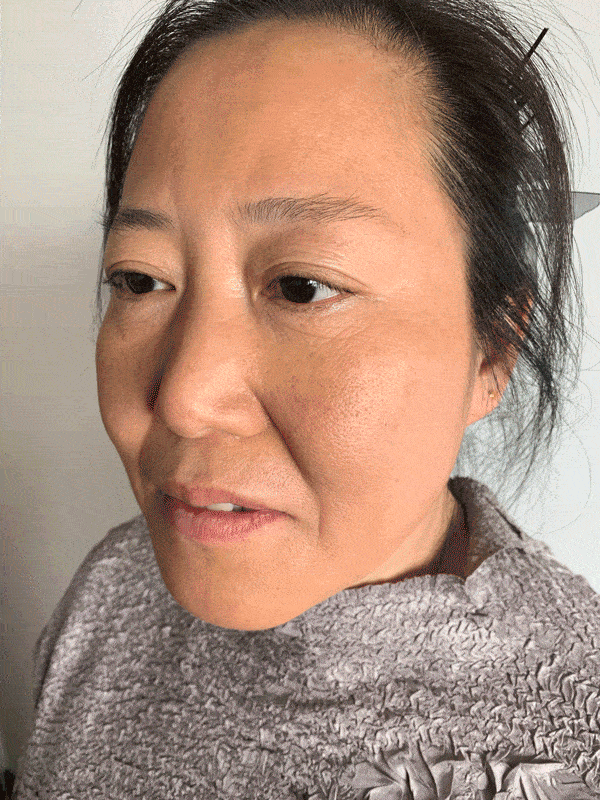 岁的她,黑黄皱纹,换脸了30岁的她,粗糙干黄,换脸了27岁的她,黑头暗斑