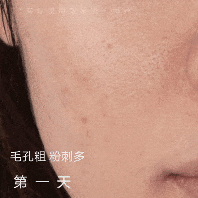 鼻子脏到挤出白条条照我这样做脸上啥脏东西都溶掉