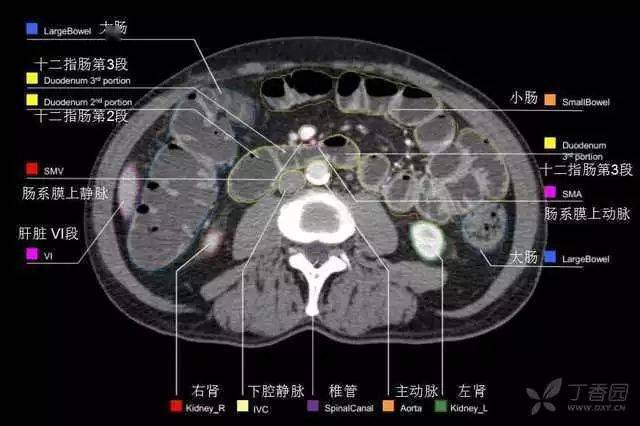 掌握這篇解剖,晉級腹部ct影像診斷高手!