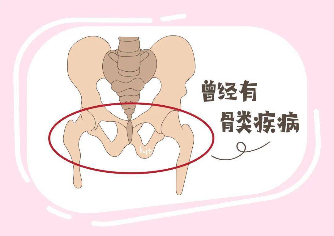 孕妇耻骨疼的位置图图片