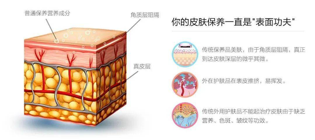 真皮层维持我们的皮肤来说,分为表皮,真皮和皮下组织,表皮是由外胚层