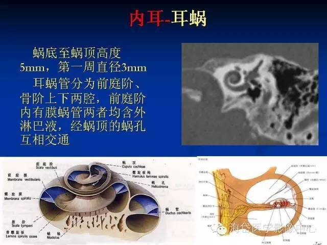 左心耳ct解剖结构图图片