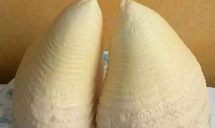 这类型乳房前突的长度大于乳房基部周围半径,从侧面看尖尖的,像个竹笋